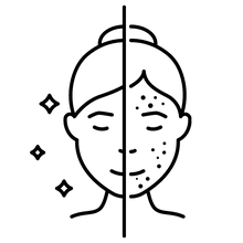 Pattanás ellen